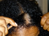 7 Reason why you may appear to have Dry Scalp or Dandruff